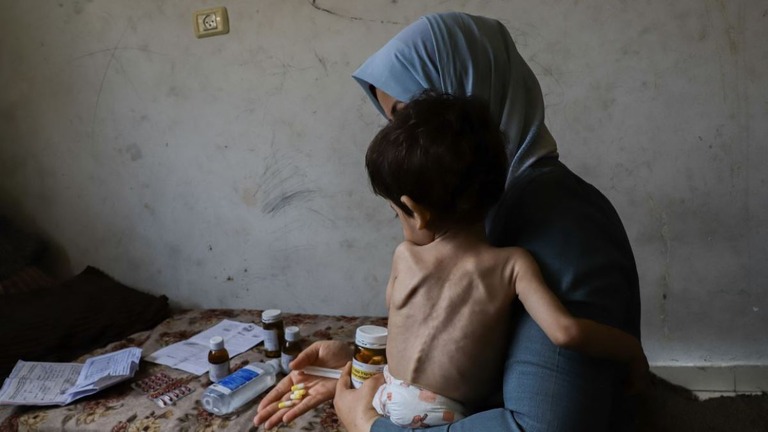 栄養失調の３歳の息子に処方された薬を見せる母親＝９日、パレスチナ自治区ガザ地区北部のジャバリヤ難民キャンプ/Abood Abusalama/AFP/Middle East Images/Getty Images